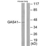 Western Blot - Anti-GAS41 Antibody (C10237) - Antibodies.com