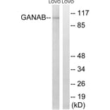 Western Blot - Anti-GANAB Antibody (C17041) - Antibodies.com