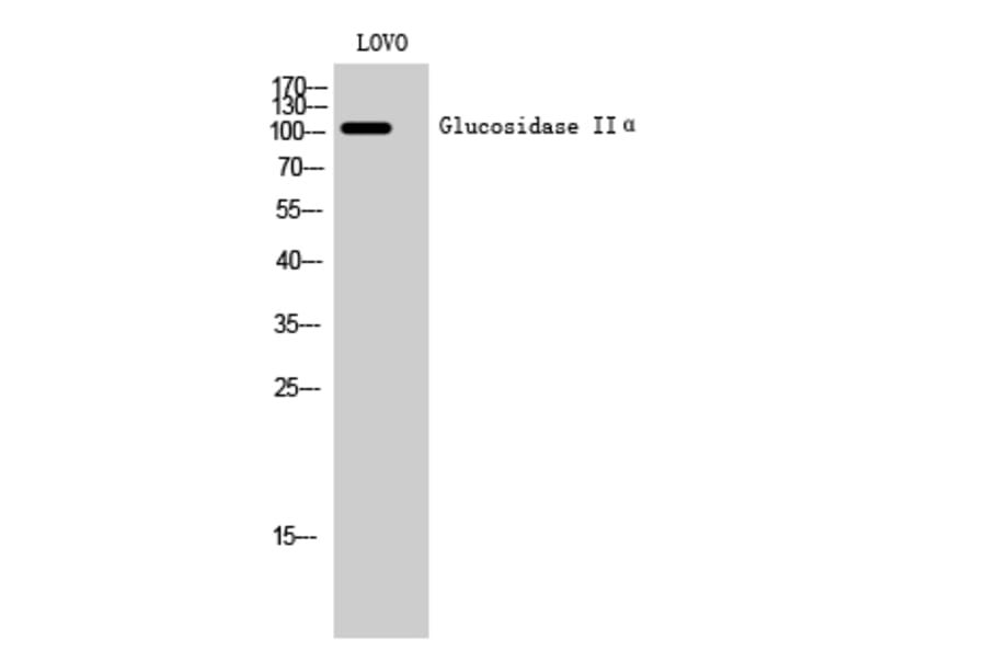 Western Blot - Anti-GANAB Antibody (C17041) - Antibodies.com