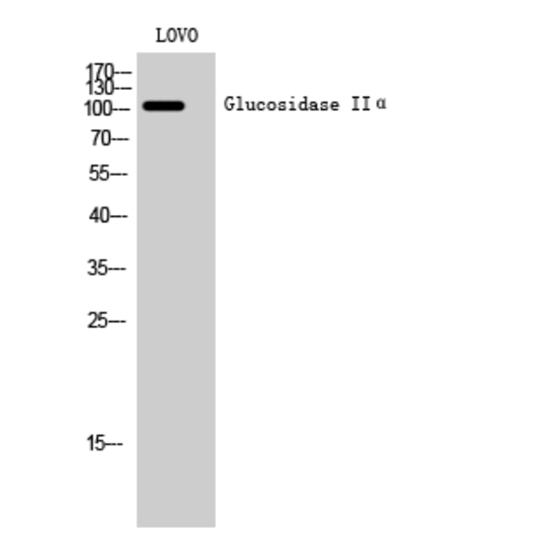Western Blot - Anti-GANAB Antibody (C17041) - Antibodies.com