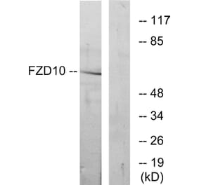 Western Blot - Anti-FZD10 Antibody (G106) - Antibodies.com