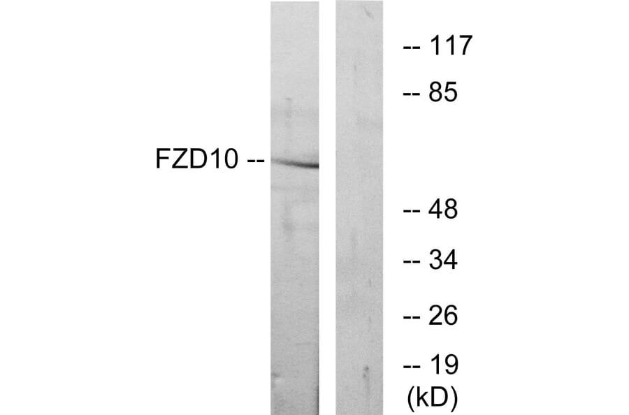 Western Blot - Anti-FZD10 Antibody (G106) - Antibodies.com