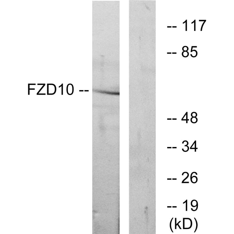 Western Blot - Anti-FZD10 Antibody (G106) - Antibodies.com