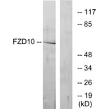 Western Blot - Anti-FZD10 Antibody (G106) - Antibodies.com