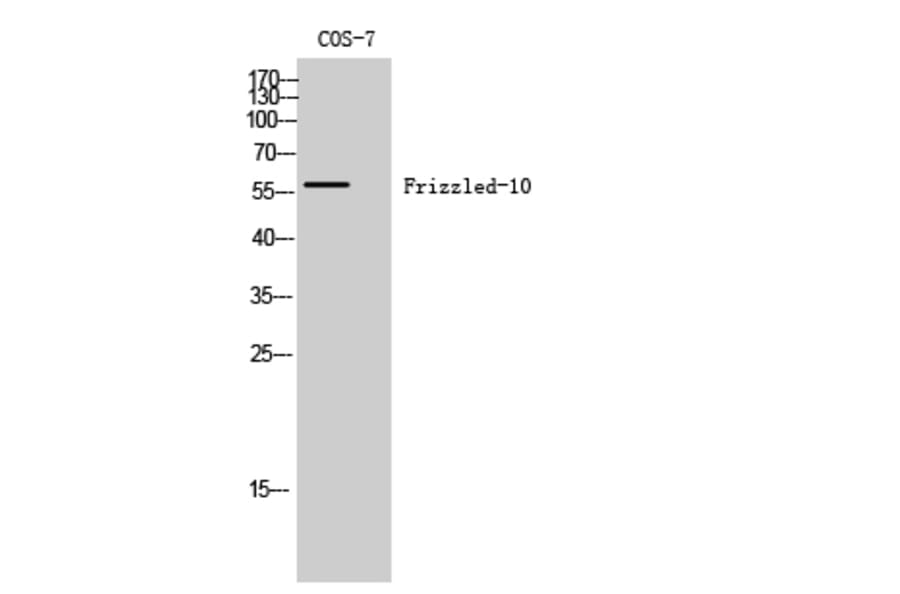 Western Blot - Anti-FZD10 Antibody (G106) - Antibodies.com