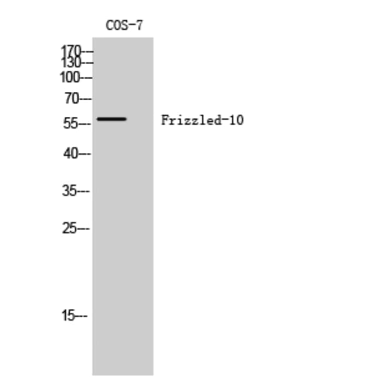 Western Blot - Anti-FZD10 Antibody (G106) - Antibodies.com