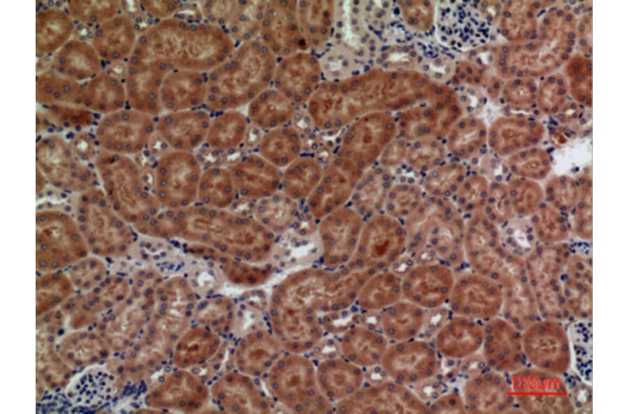 Immunohistochemistry - Anti-FZD10 Antibody (C30530) - Antibodies.com