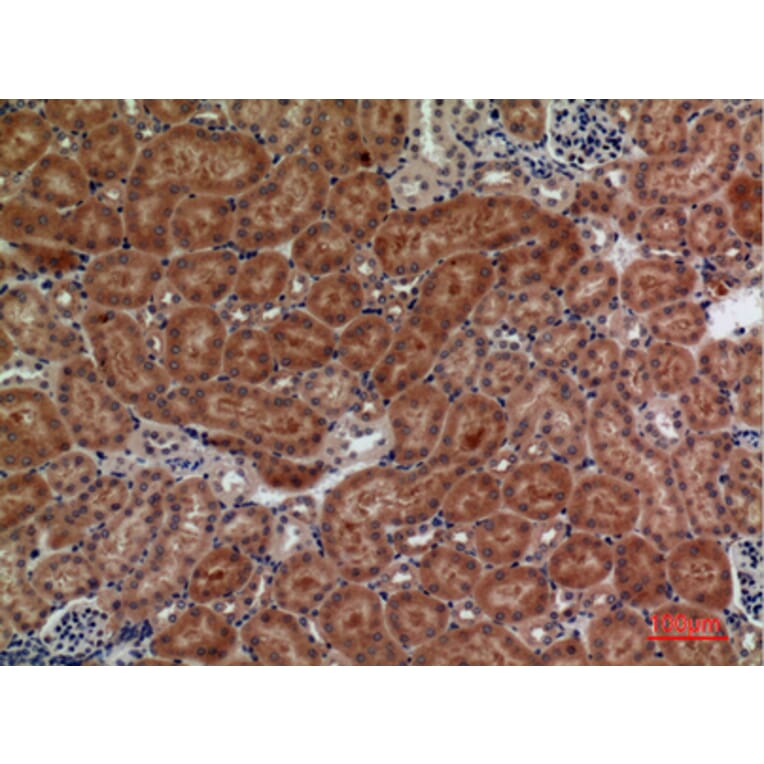 Immunohistochemistry - Anti-FZD10 Antibody (C30530) - Antibodies.com