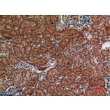 Immunohistochemistry - Anti-FZD10 Antibody (C30530) - Antibodies.com