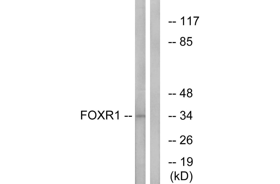 Western Blot - Anti-FOXR1 Antibody (C15804) - Antibodies.com