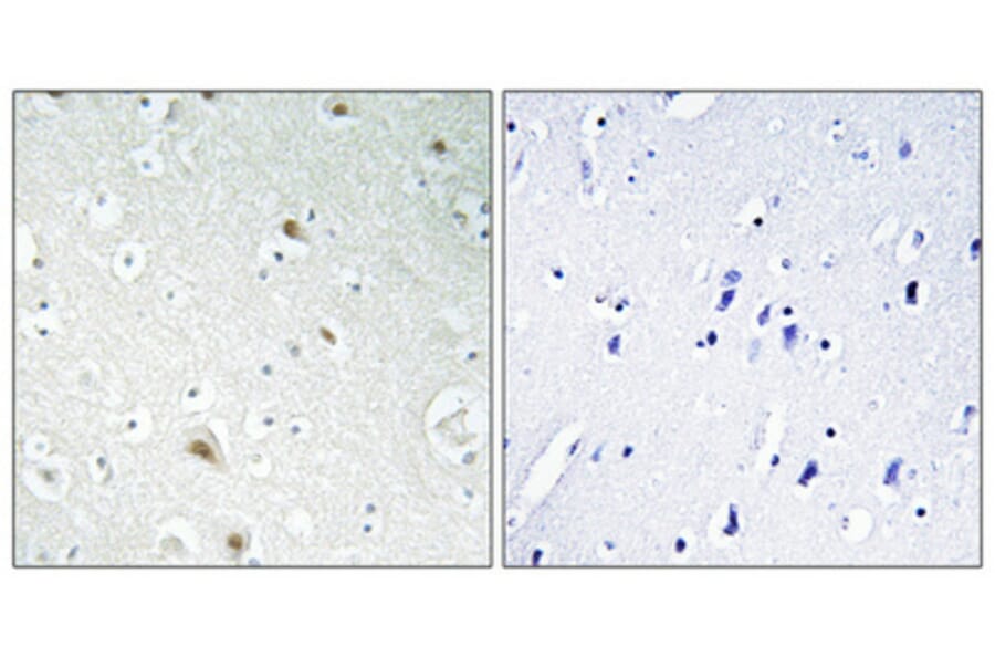 Immunohistochemistry - Anti-FOXR1 Antibody (C15804) - Antibodies.com