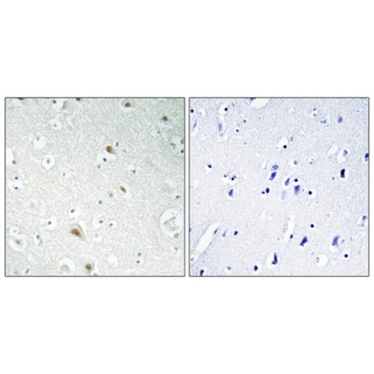 Immunohistochemistry - Anti-FOXR1 Antibody (C15804) - Antibodies.com