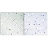 Immunohistochemistry - Anti-FOXR1 Antibody (C15804) - Antibodies.com