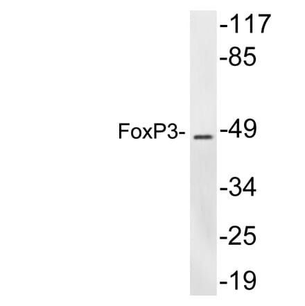 Western Blot - Anti-FoxP3 Antibody (R12-2145) - Antibodies.com