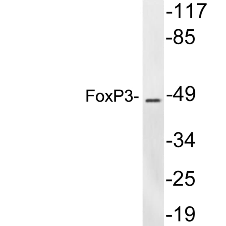 Western Blot - Anti-FoxP3 Antibody (R12-2145) - Antibodies.com