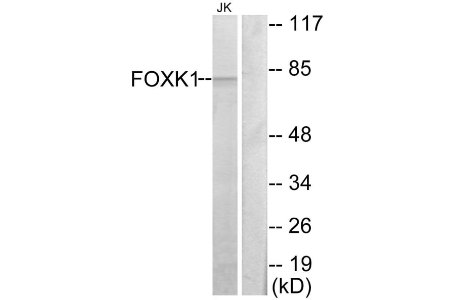 Western Blot - Anti-FOXK1 Antibody (C10811) - Antibodies.com