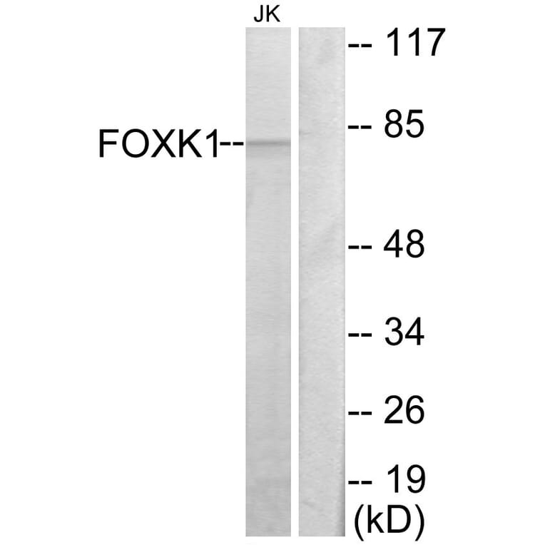 Western Blot - Anti-FOXK1 Antibody (C10811) - Antibodies.com