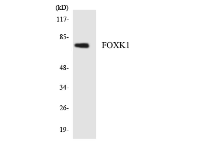 Western Blot - Anti-FOXK1 Antibody (R12-2775) - Antibodies.com