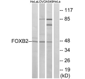 Western Blot - Anti-FOXB2 Antibody (C15767) - Antibodies.com