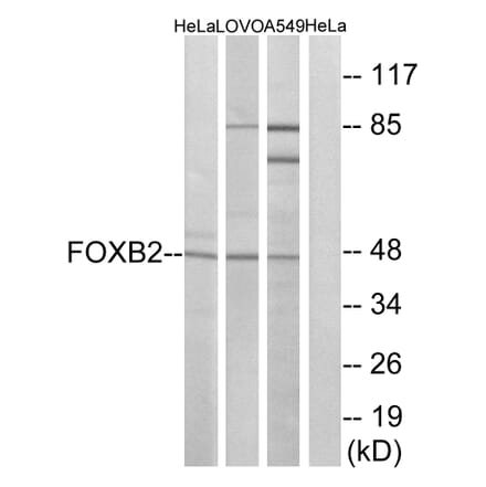 Western Blot - Anti-FOXB2 Antibody (C15767) - Antibodies.com