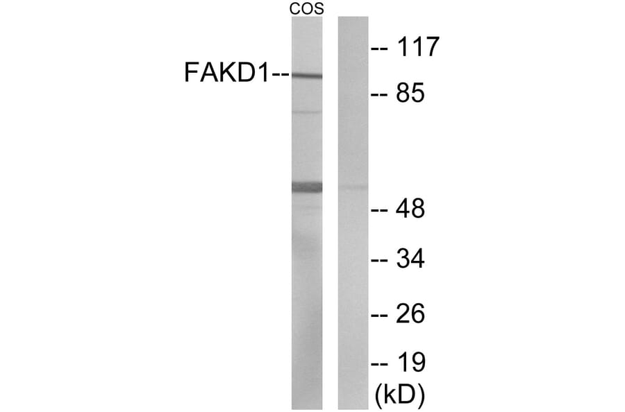 Western Blot - Anti-FAKD1 Antibody (C11173) - Antibodies.com