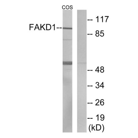 Western Blot - Anti-FAKD1 Antibody (C11173) - Antibodies.com