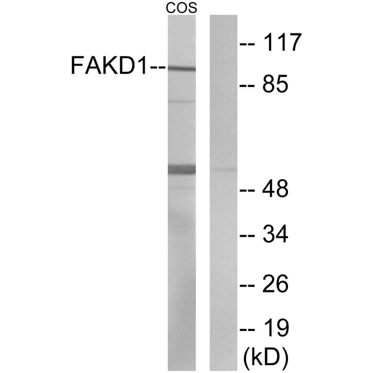 Western Blot - Anti-FAKD1 Antibody (C11173) - Antibodies.com