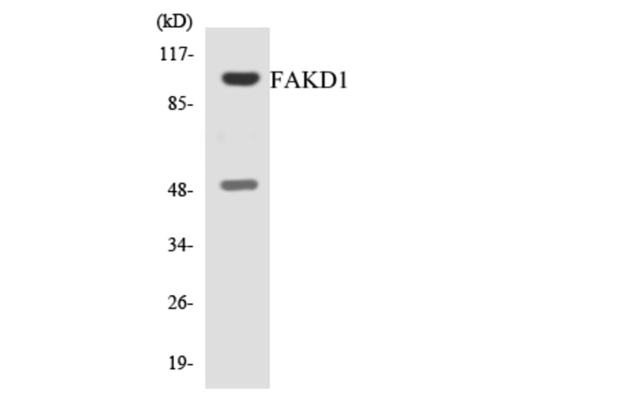 Western Blot - Anti-FAKD1 Antibody (R12-2763) - Antibodies.com