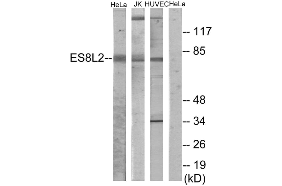 Western Blot - Anti-ES8L2 Antibody (C11699) - Antibodies.com