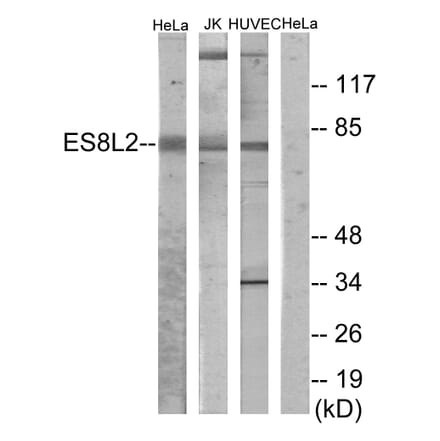 Western Blot - Anti-ES8L2 Antibody (C11699) - Antibodies.com