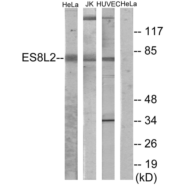 Western Blot - Anti-ES8L2 Antibody (C11699) - Antibodies.com