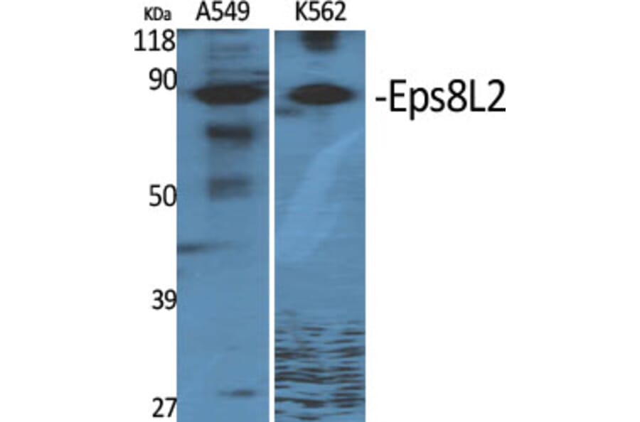 Western Blot - Anti-ES8L2 Antibody (C11699) - Antibodies.com