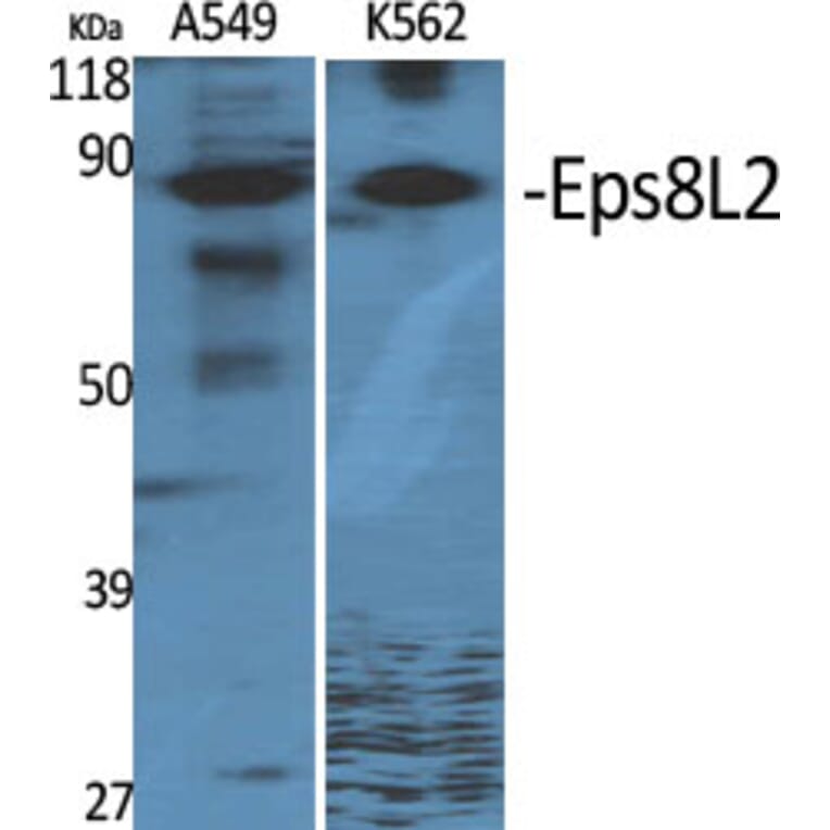 Western Blot - Anti-ES8L2 Antibody (C11699) - Antibodies.com