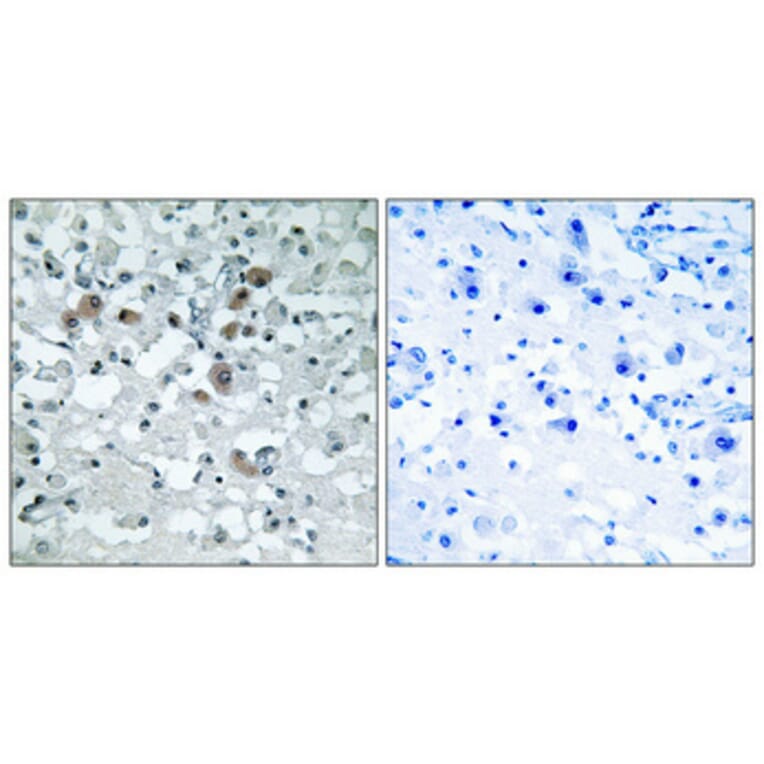 Immunohistochemistry - Anti-ERD23 Antibody (C15674) - Antibodies.com