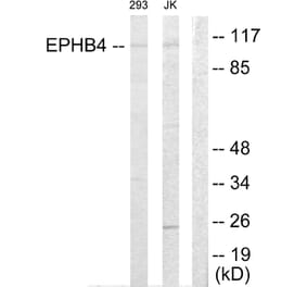 Western Blot - Anti-EPHB4 Antibody (C10732) - Antibodies.com