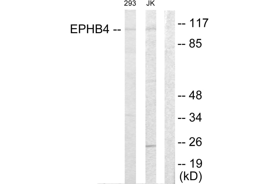 Western Blot - Anti-EPHB4 Antibody (C10732) - Antibodies.com