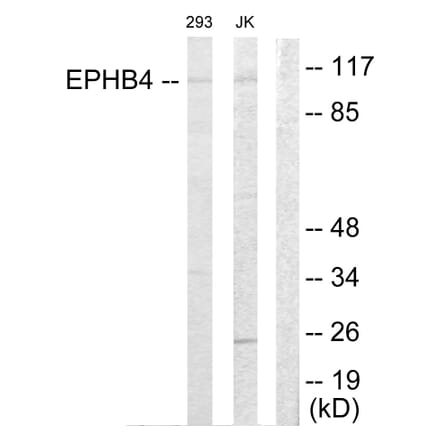 Western Blot - Anti-EPHB4 Antibody (C10732) - Antibodies.com