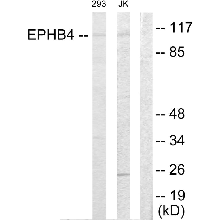 Western Blot - Anti-EPHB4 Antibody (C10732) - Antibodies.com