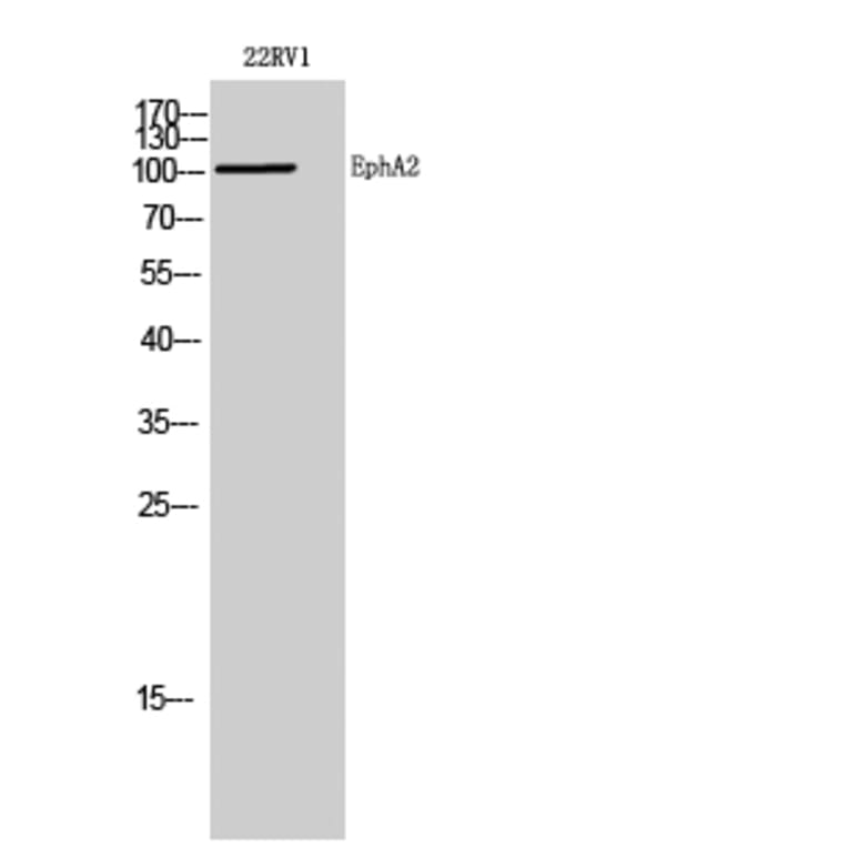 Western Blot - Anti-EPHA2 Antibody (C21139) - Antibodies.com