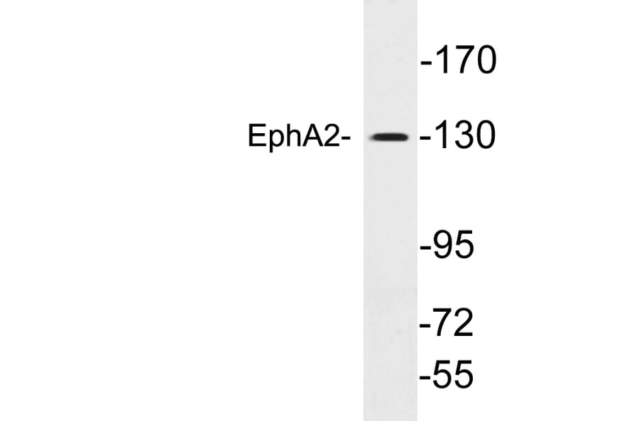 Western Blot - Anti-EphA2 Antibody (R12-2135) - Antibodies.com