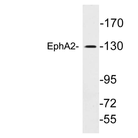 Western Blot - Anti-EphA2 Antibody (R12-2135) - Antibodies.com