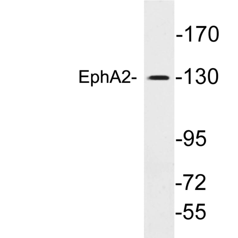 Western Blot - Anti-EphA2 Antibody (R12-2135) - Antibodies.com