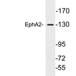 Western Blot - Anti-EphA2 Antibody (R12-2135) - Antibodies.com