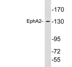 Western Blot - Anti-EphA2 Antibody (R12-2136) - Antibodies.com