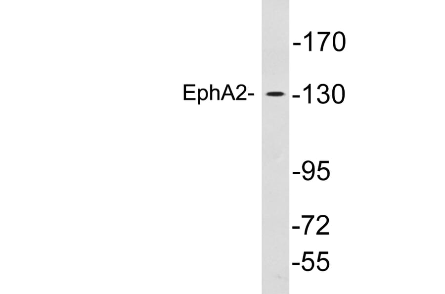 Western Blot - Anti-EphA2 Antibody (R12-2136) - Antibodies.com