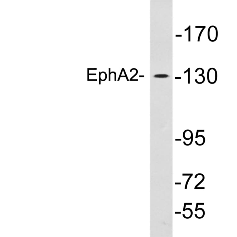 Western Blot - Anti-EphA2 Antibody (R12-2136) - Antibodies.com