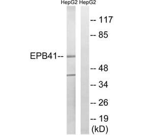 Western Blot - Anti-EPB41 Antibody (B8341) - Antibodies.com