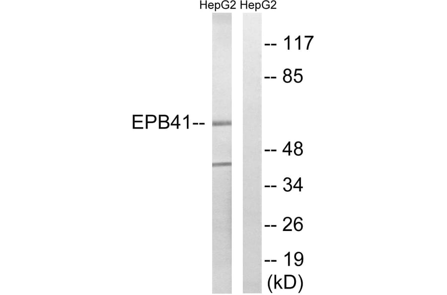 Western Blot - Anti-EPB41 Antibody (B8341) - Antibodies.com