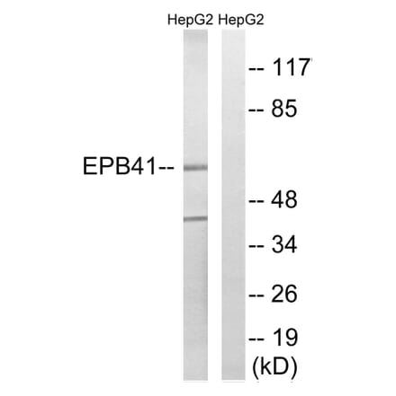 Western Blot - Anti-EPB41 Antibody (B8341) - Antibodies.com
