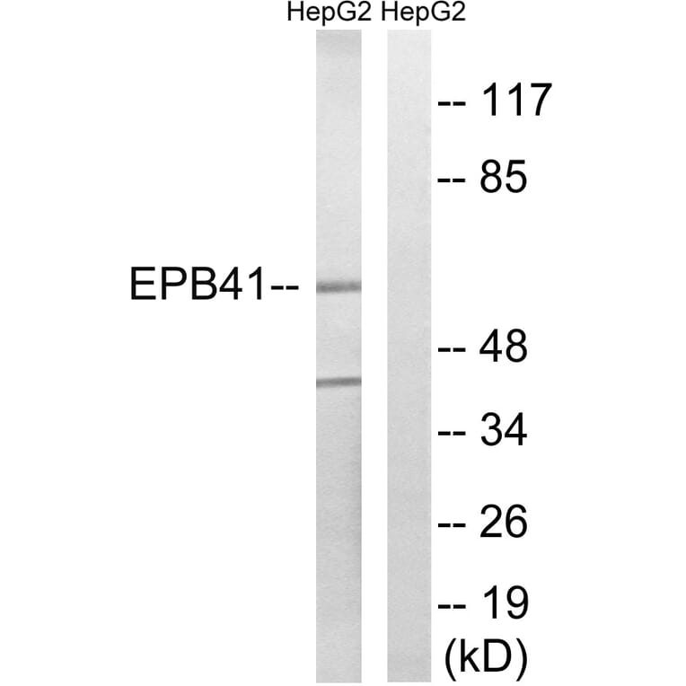 Western Blot - Anti-EPB41 Antibody (B8341) - Antibodies.com